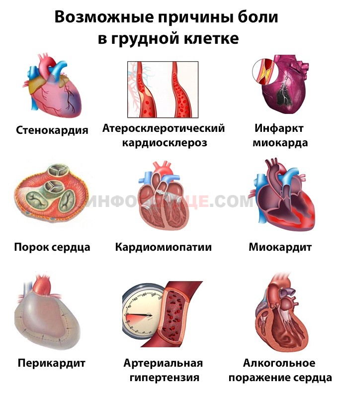 Причины боли сердца у мужчин. Болит сердце. Болит сердце причины. Отчего может болеть сердце.