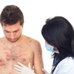 Инфекционные поражения дермы и мягких тканей