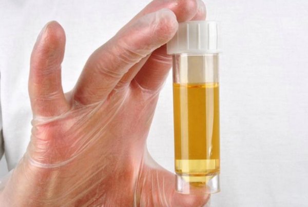 Урина, вырабатываемая почками, имеет иммунные клетки