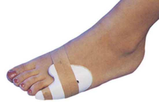 4 отличия — чтобы определить перелом у Вас или ушиб пальца ноги thumbnail