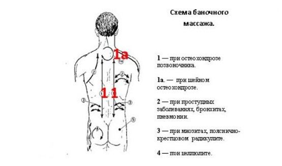 Схема баночного массажа
